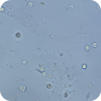 Цилиндроиды